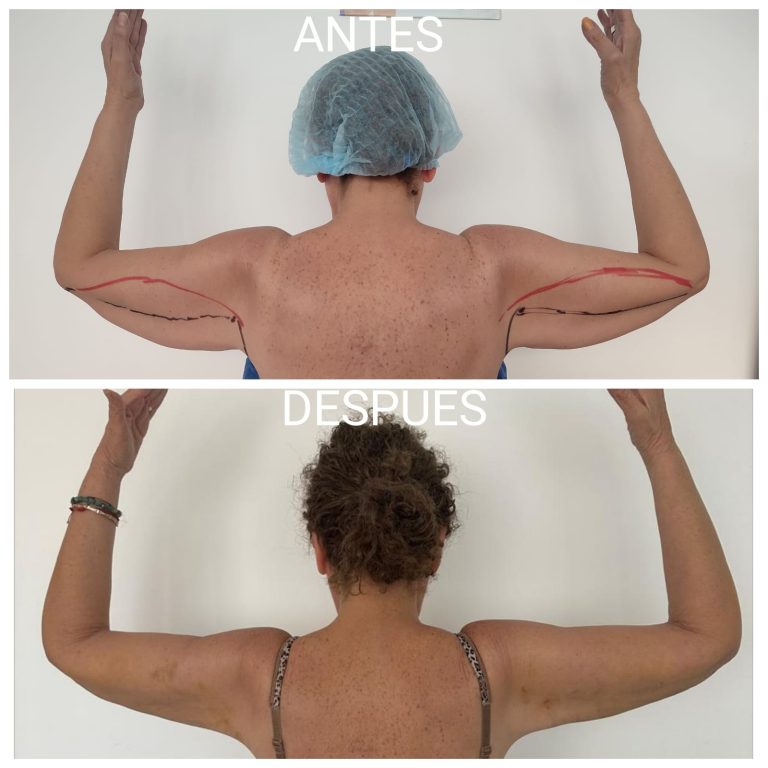 WhatsApp Image 2026-03-07 at 17.11.10